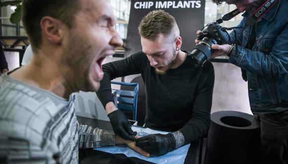 Suecia. Un hombre reacciona al chip que le colocaron a su mano. (Foto: AFP)
