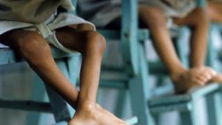 Cáritas de Venezuela atendió en 2017 doble de niños desnutridos que en 2016
