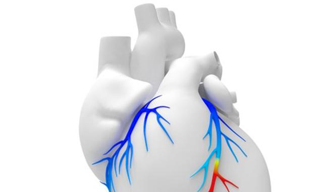 FOTO 6 | HeartFlow es una empresa de tecnología médica competitiva que ha recibido financiación de inversores como US Venture Partners y GE Ventures. Año de fundación: 2007. Total recaudado: US$ 467 millones. Valoración actual: US$ 1,500 millones. Qué hace: HeartFlow desarrolla herramientas que ayudan a los médicos a analizar las arterias coronarias bloqueadas sin requerir cirugía invasiva. (Foto: HeartFlow)