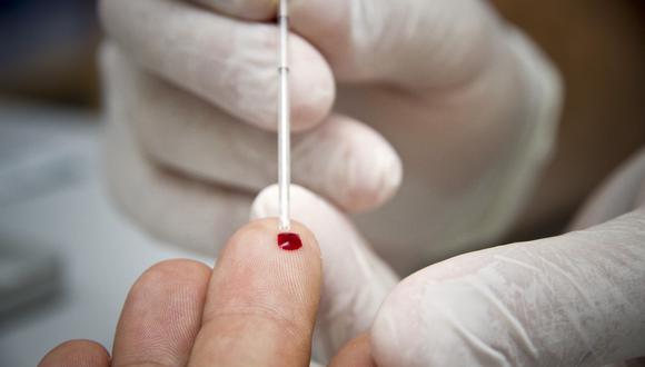 Pruebas de VIH. (Foto: AFP)