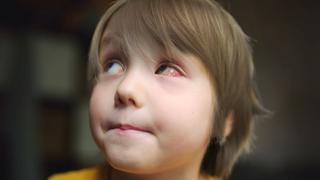 Recomendaciones para evitar traumas oculares en los niños