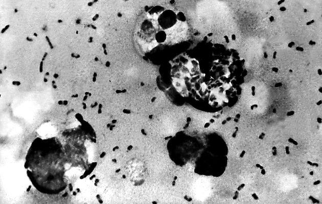 La Peste Negra redujo la población de Europa en un 40% en menos de dos años. (Foto: AFP)