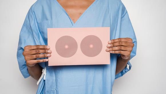 Esto puede reducir a la larga el número de radiólogos dedicados al cribado del cáncer de mama. (Foto: Pexel)