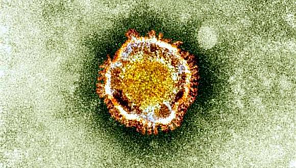 El nuevo coronavirus produce neumonía. (Foto: AFP)