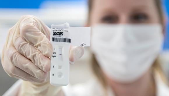 Hay dos tipos de pruebas de COVID-19 usadas actualmente: las serológicas y las de PCR. (Foto: SEBASTIEN BOZON / AFP)