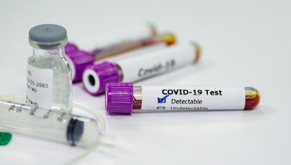 Los test serológicos consisten en un análisis de sangre con el fin de saber si el paciente desarrolló anticuerpos contra el SARS-CoV-2. (Foto: iStock)