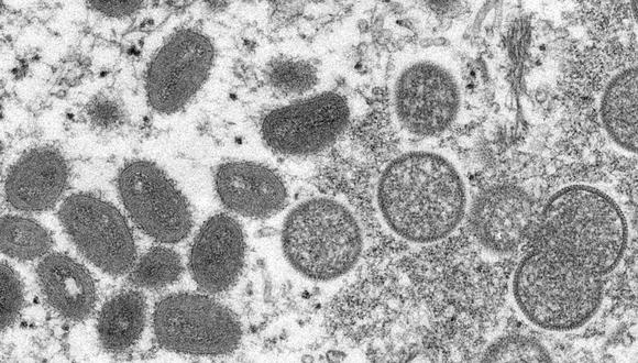 Viriones maduros y ovalados de la viruela símica, a la izquierda, y viriones esféricos inmaduros, a la derecha, extraídos de una muestra de piel humana relacionada con un brote de ese año.