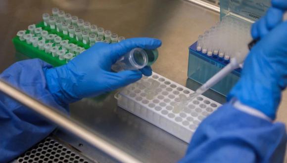 El Gobierno aprobó la adquisición de 320 mil pruebas moleculares para detectar el coronavirus. (Foto: Minsa / Referencial)