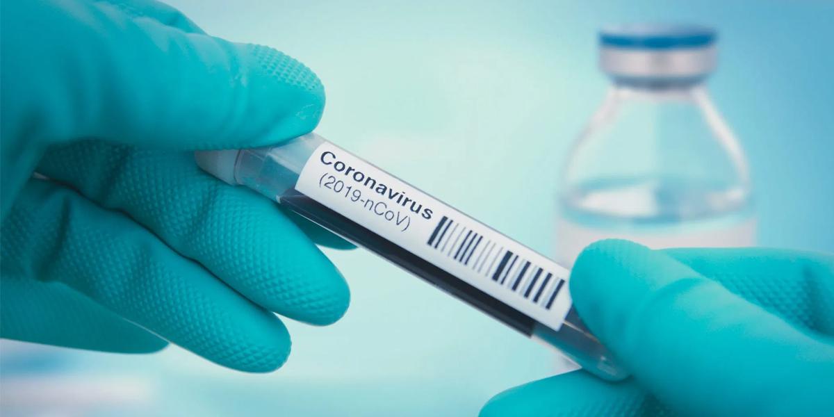 FOTO 1 | 1. Pruebas, pruebas y más pruebas (Foto: iStock)