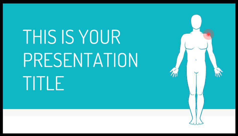 Foto: Slides Carnival