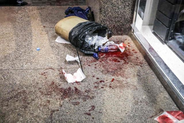 Varias personas resultaron heridas, entre ellas un hombre que fue golpeado a palos por los manifestantes. Otro hombre yacía en un charco de sangre en el pavimento. (Foto: AFP)