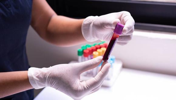 El método se aplicó a la sangre de 22 donantes anónimos y se examinó para detectar la presencia de cinco polímeros diferentes, los componentes básicos del plástico. (Foto: Pexels)
