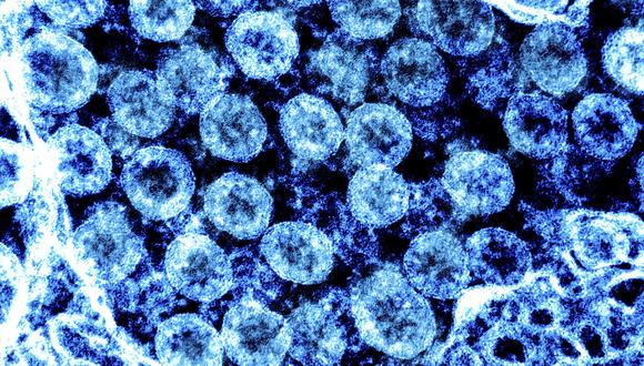 Un primer estudio con modelos teóricos sugirió que el clima no era un factor importante, dado el gran número de personas susceptibles sin inmunidad previa contra el virus. (AFP)