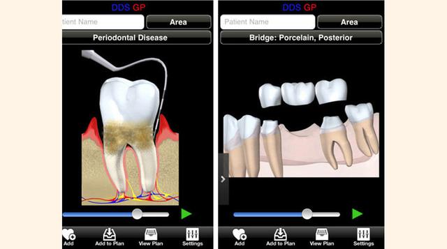 DDS GP Yes!: US$ 499, Pertenece al campo de la odontología. Busca informar a los pacientes de clínicas dentales sobre cómo será su proceso requerido al dentista. Esta app tiene varios galardones y se encuentra en más de 10 idiomas. (Foto: Forbes)