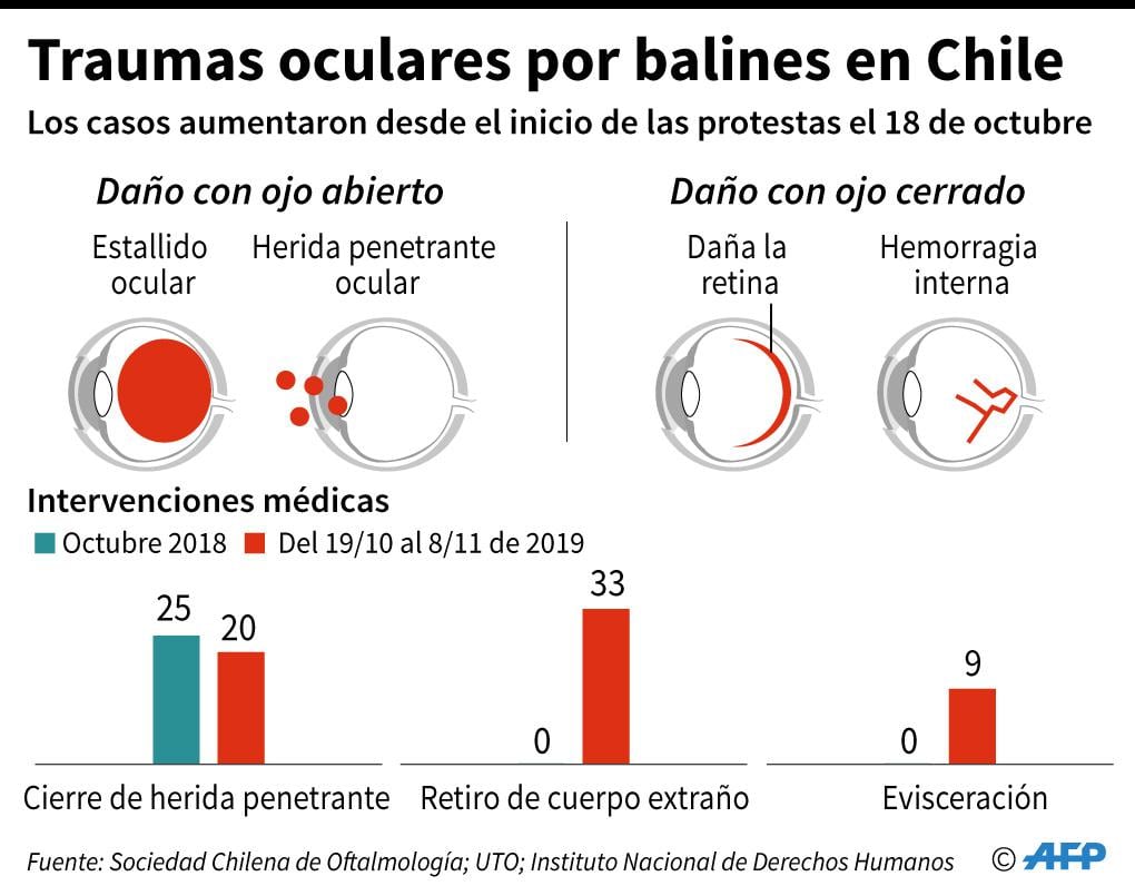 Gráfico explicativo sobre las heridas oculares producidas por balines antidisturbios durante las protestas que cumplen tres meses en Chile, y comparación de las intervenciones médicas realizadas entre el 18 de octubre y el 8 de noviembre de 2019 y octubre del año anterior. (AFP)