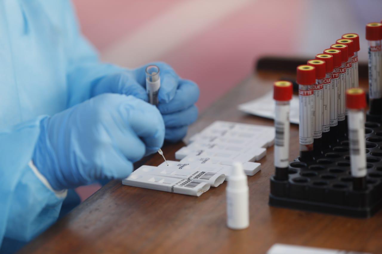 Ministro de Salud aseguró que el número de pruebas diarias que se realizan en nuestro país se elevó de 500 a 9000 en promedio.   (Foto: Diana Marcelo/GEC)