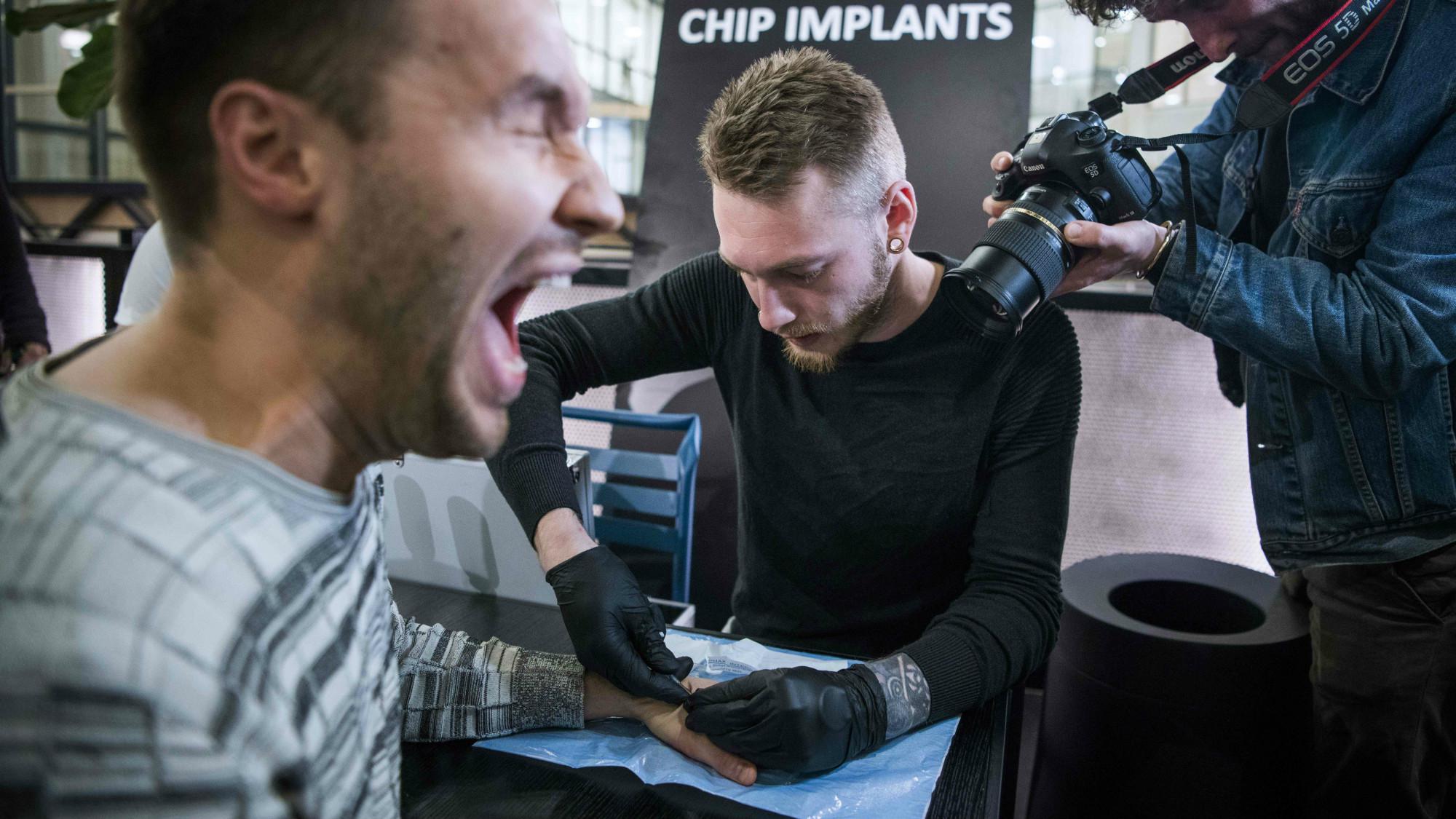 Suecia. Un hombre reacciona al chip que le colocaron a su mano. (Foto: AFP)