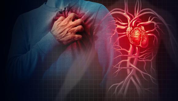 La insuficiencia cardíaca es la principal causa de hospitalización en personas mayores de 65 años y una importante causa de mortalidad, subrayó hoy el Centro Nacional de Investigaciones Cardiovasculares. (Foto: iStock)