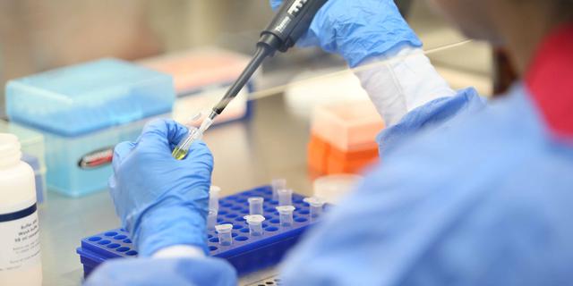 FOTO 3 | En cuanto a los laboratorios de pruebas moleculares, se señala que se empezó la pandemia con un laboratorio que procesaba pruebas moleculares, unas 500 pruebas al día. A la fecha se cuenta con 15 laboratorios operativos con una capacidad de producción de 2,160 pruebas diarias. Además, se cuentan con 24 laboratorios en habilitación y evaluación. (Foto: INS / Minsa)