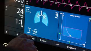 Demanda mundial de respiradores supera en 10 la disponibilidad