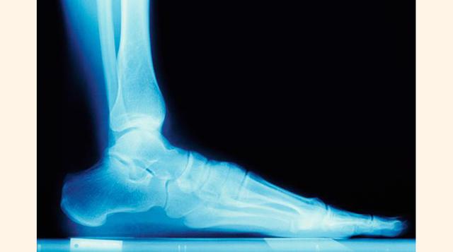 9.- Médicos podólogos. (foto: batanga).