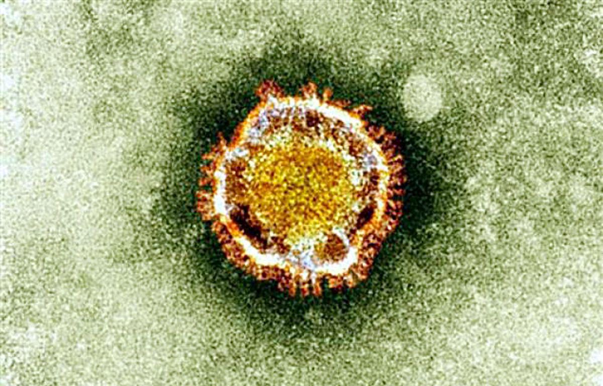 El nuevo coronavirus llamado 2019-nCoV es más mortal que la gripe, pero menos virulento que las epidemias precedentes de coronavirus: SRAS y MERS. (Foto: AFP/Agencia Británica de Protección de la Salud)