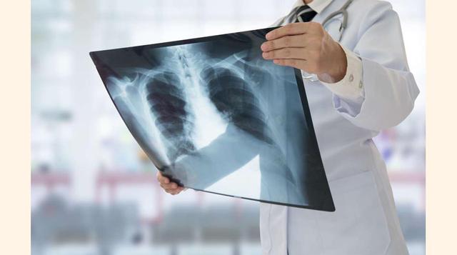 FOTO 16 | Al hacer experimentos para entender la relación entre los rayos X (descubiertos por el físico alemán Wilhelm Röntgen) y la fluorescencia, Henri Becquerel descubre la radioactividad en 1896. Realizó un experimento con cristales de sal de uranio f