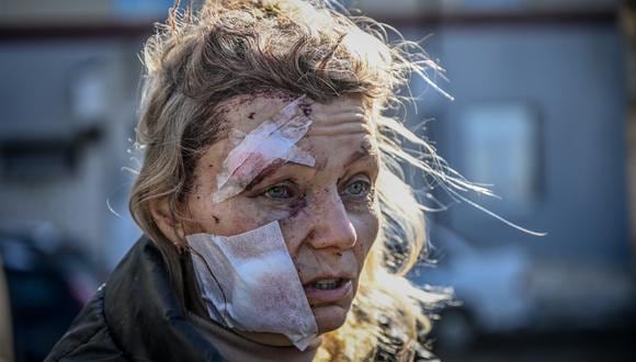 Mujer víctima de la agresión de Rusia a Ucrania (Foto: AFP)