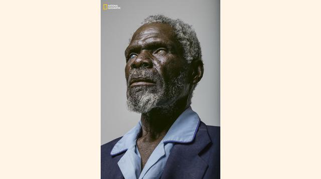 Retrato de la ceguera. (Foto: Brent Stirton / National Geographic)