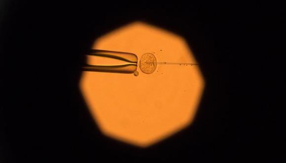 Una imagen de un microscopio electrónico muestra la manipulación de los ovocitos. (Foto: Bloomberg)