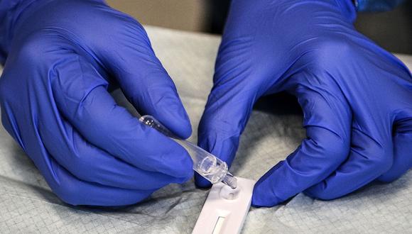 Un trabajador médico coloca una gota de una muestra en un revelador después de realizar una prueba de antígeno para COVID-19 en un centro de detección. Photographer: Christophe Archambault/AFP/Getty Images