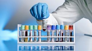 Estados Unidos acusa a más laboratorios de colusión en precios de genéricos