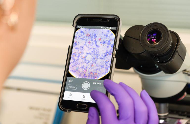 (Foto: Cambridge Consultants)