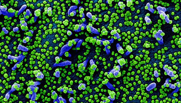 Imágenes de partículas del coronavirus sobre una célula humana, tomadas con un microscopio electrónico y coloreadas en forma artificial. (Foto: National Institute of Allergy and Infectious Diseases [NIAID])