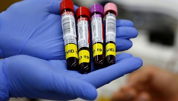 Todos los países de la UE autorizan a los vacunados a realizar donaciones de sangre. (AFP / GIL COHEN-MAGEN).
