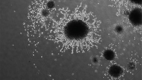 Organoide placentario (círculo en el centro). Las células trofoblásticas están invadiendo el organoide, imitando a las células de la placenta que invaden el útero en las primeras semanas del embarazo. Crédito: Instituto Friedrich Miescher/Universidad de Cambridge.