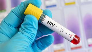 Desigualdades sexual, racial y económica alargan pandemia del sida, alerta la ONU