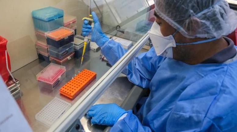 La vacuna pasaría por varias pruebas antes de ser aplicada en humanos. (Foto: Difusión)