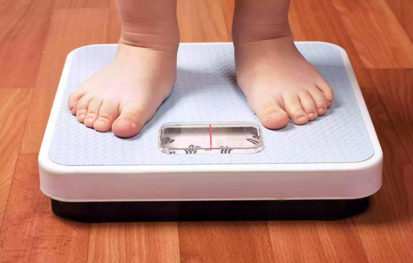obesidad infantil