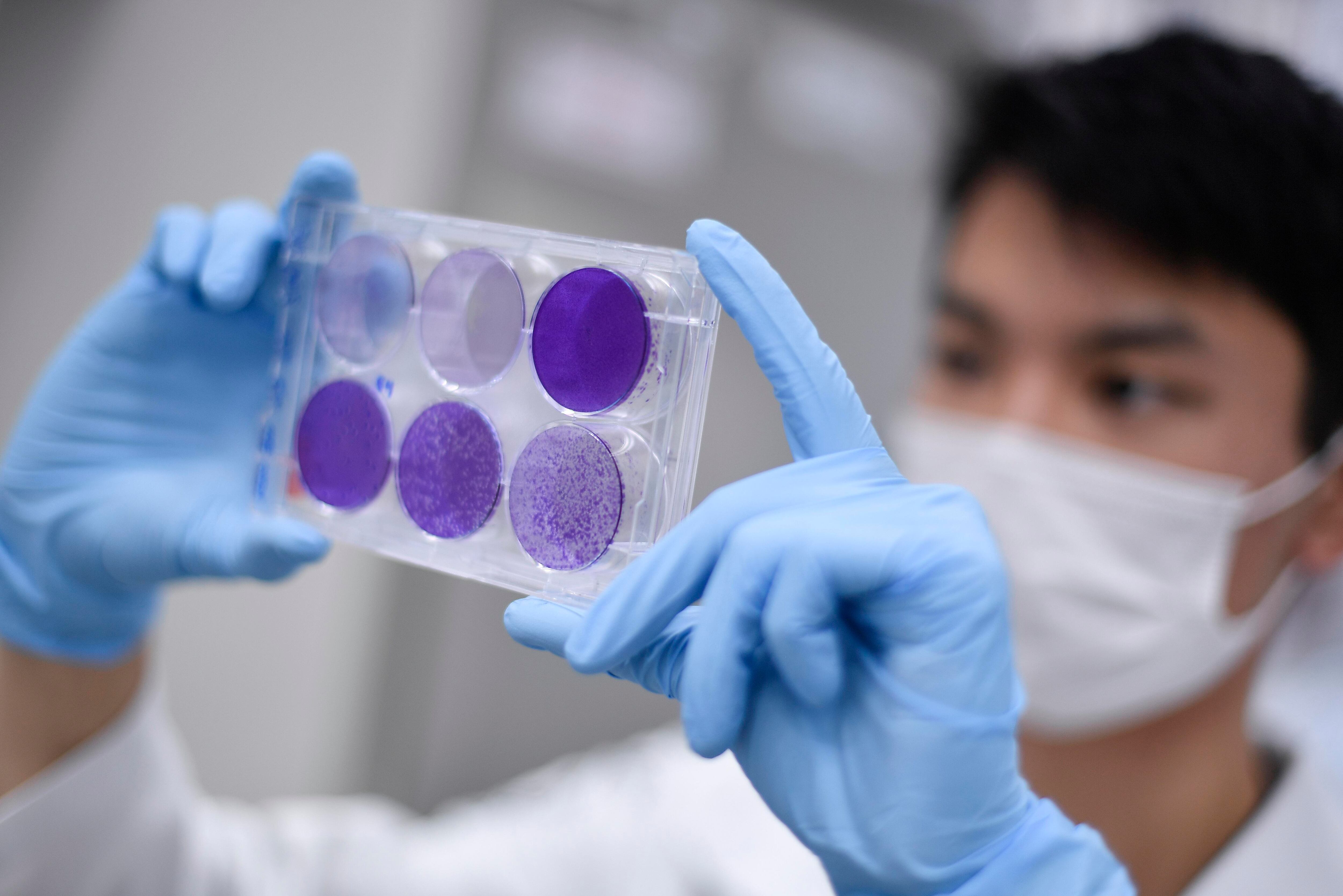 Existen al menos 44 proyectos que trabajan en la búsqueda de una vacuna contra el Covid-19. (Douglas MAGNO / AFP)