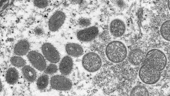 Una imagen microscópica electrónica (EM) muestra partículas maduras del virus de la viruela del simio de forma ovalada.