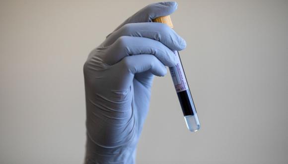 La licitación de Public Health England se produce después de que las iniciativas de Gran Bretaña para el testeo del coronavirus fueran criticadas por informes de pruebas faltantes y largas esperas de resultados. (Bloomberg)