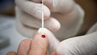 Detección de casos de VIH cayó 55% en Perú por limitaciones de la pandemia