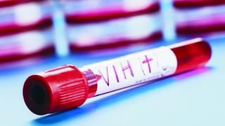 Vacuna evita infecciones de VIH en mujeres, según estudio