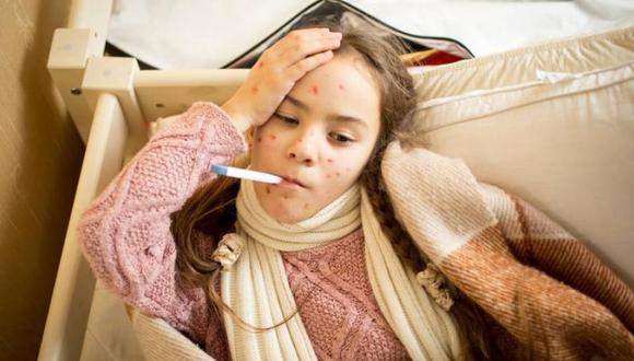 La OMS explica que las complicaciones se presentan más en menores de 5 años y adultos mayores de 30. (Foto: Shutterstock)