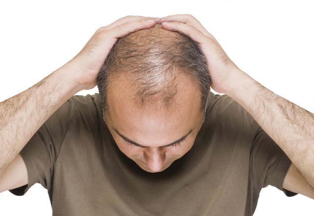 FOTO 9 | Ni es bueno para tu salud ni es favorable en tu relación con la empresa y con los compañeros. Hay que aprender no cargar con todas las tareas.