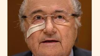 Reacciones a la suspensión de Blatter y Platini