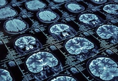 Mayor estudio sobre drogas psicodélicas revela cómo estas reorganizan el cerebro humano