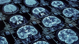 Mayor estudio sobre drogas psicodélicas revela cómo estas reorganizan el cerebro humano