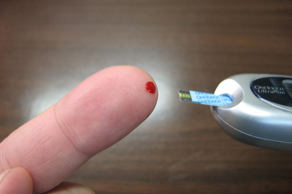 El costo de la asistencia médica es muy alto en los países desarrollados. (Foto: Paul Hunt/Pixabay)